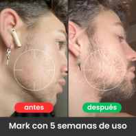 🔥Bálsamo para Crecimiento de Barba Ultra Potente con Minoxidil 20% | 100mL🔥