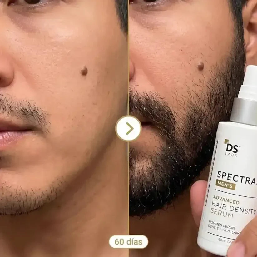Spectral - Nanoxidil™ - Recupera Cabello y Barba Desde la Raíz - 50% Off