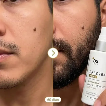 Spectral - Nanoxidil™ - Recupera Cabello y Barba Desde la Raíz - 50% Off