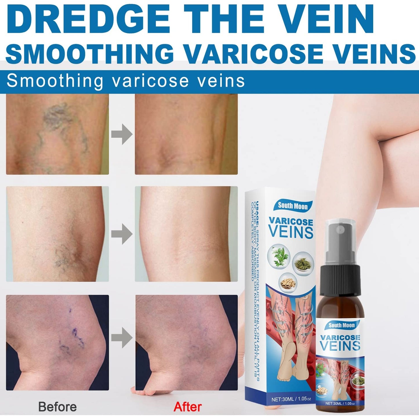 SPRAY ANTI VARICES - ADIOS VENAS  (30 ml)