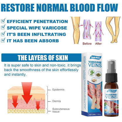 SPRAY ANTI VARICES - ADIOS VENAS  (30 ml)