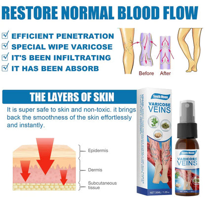 SPRAY ANTI VARICES - ADIOS VENAS  (30 ml) -Últimas 7 Unidades 🔥