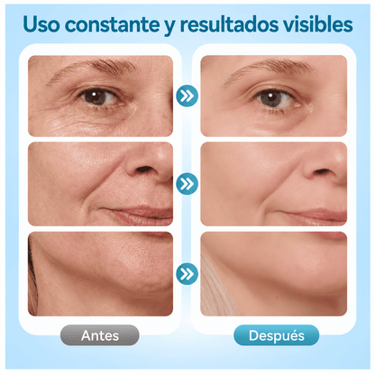 Masajeador Facial Papada Pantalla 7LED Reafirmante y Antiedad✨