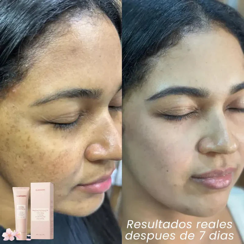 🔥Quarxery Gel Exfoliante Corporal – Autocuidado Suave para Todo el Cuerpo - Últimas 7 Unidades 🔥