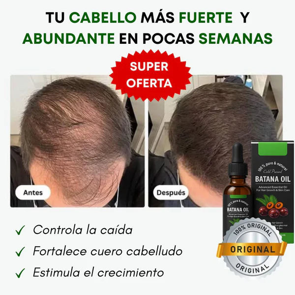 Aceite de Batana - Reparación Profunda y Brillo Intenso ✨