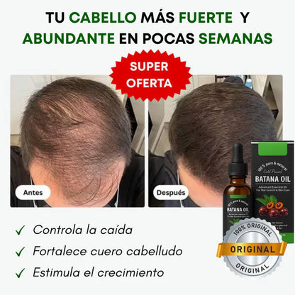 Aceite de Batana - Reparación Profunda y Brillo Intenso ✨