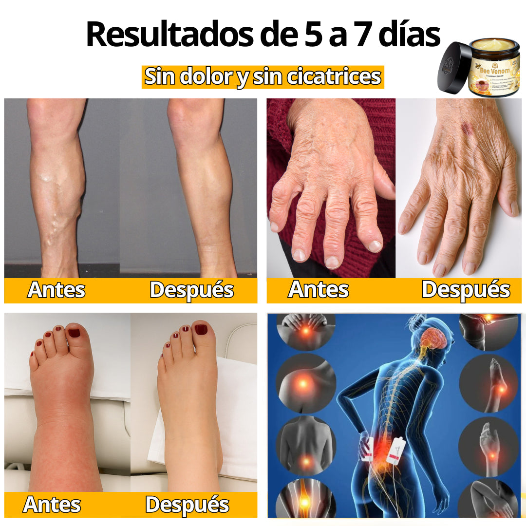 Bee Venom Bswell - Crema Para Dolores con Veneno de Abeja - Últimas 7 Unidades 🔥